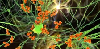 ভারতে ছড়াচ্ছে জিবিএস রোগ, প্রথম মৃত্যু